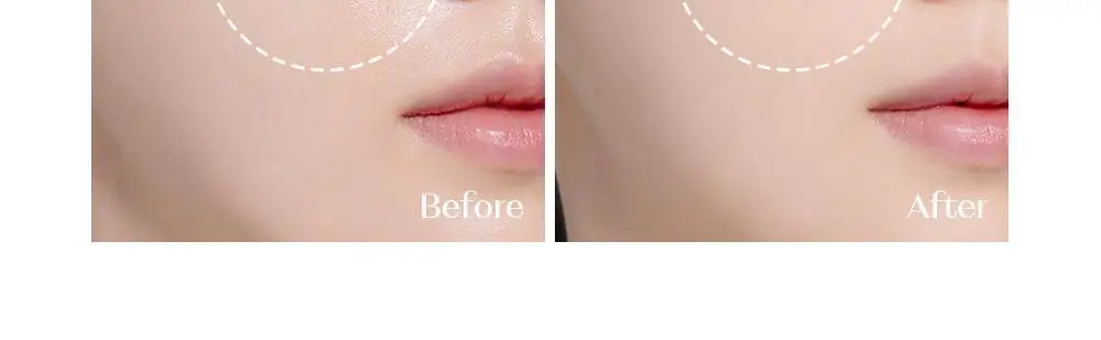 [리뉴얼] 에뛰드 피지쏙 파우더 5g 상세페이지 6